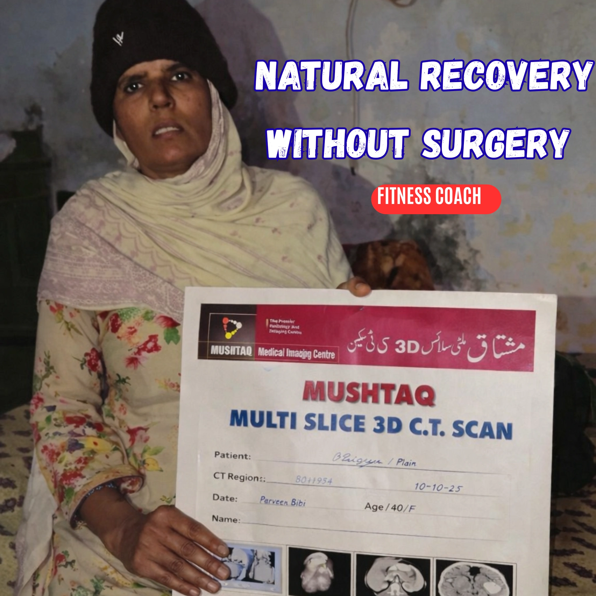 Natural Improvement Without Surgery